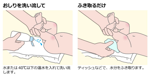 おむつかぶれ対策に 赤ちゃんおしりシャワーｒでおしりを手軽に洗おう べびちぇる By リッチェル